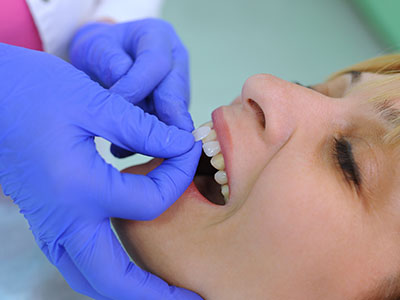 Elite Dental Club | Emergency Treatment, CEREC and Cosmetic Dentistry