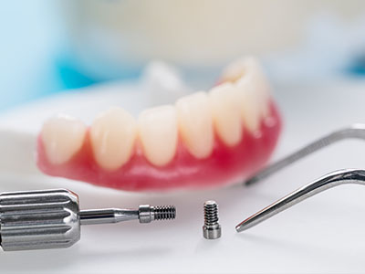 Elite Dental Club | Dentures, Sedation Dentistry and General Exam