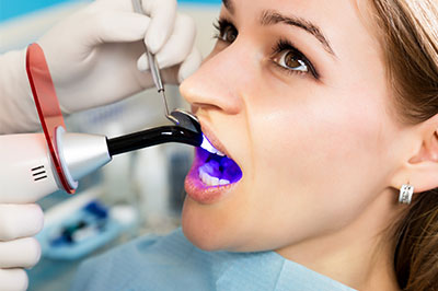 Elite Dental Club | Dentures, Night Guards and Tooth Filling