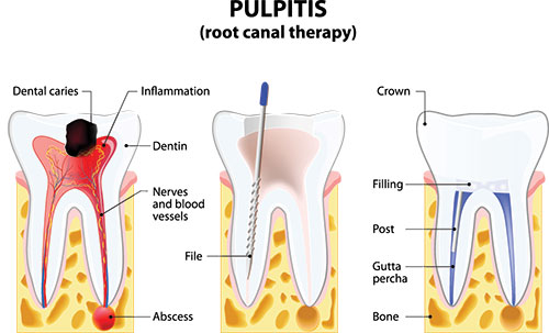 Elite Dental Club | Cosmetic Dentistry, Dentures and Night Guards